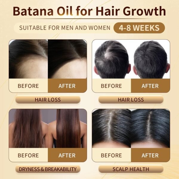 Batana Oil for Hair Growth, 100% Pure & Organic Batana Oil, Cold Pressed Traditional Palm Nut Oil, Unrefined Hair Growth Oil Prevents Hair Loss - Image 6