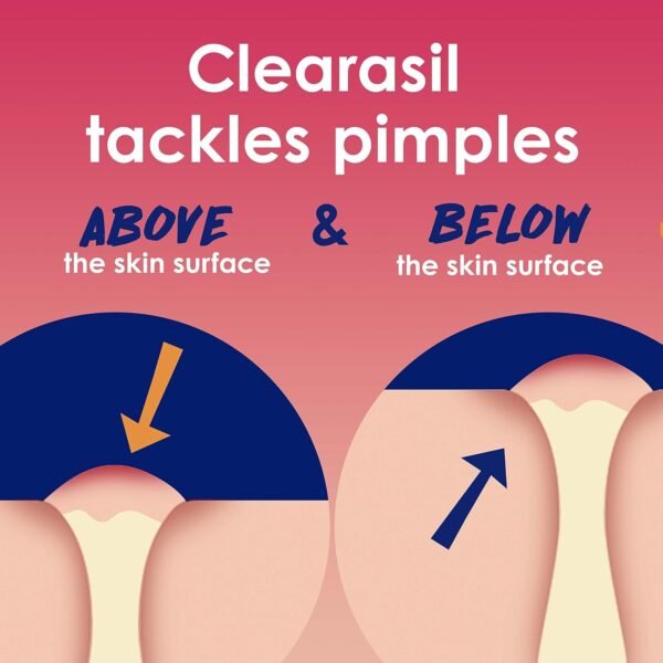 Clearasil Rapid Rescue Deep Treatment Acne Face Pads, Maximum Strenght with 2% Salicylic Acid Acne Treatment Medicine, 90 Count - Image 4