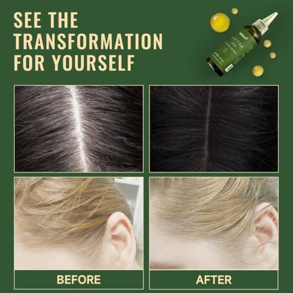Batana Oil - Dr Sebi Organic Oil for Hair Growth, 100% Raw Pure Natural from Honduras, Deeply Nourishing Scalp for Thicker & Stronger Hair, 4.05 fl oz - Image 3