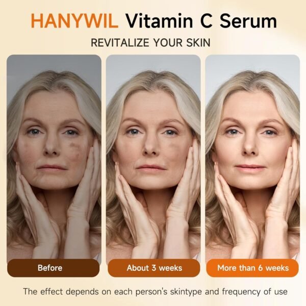 Super Vitamin C Serum for Women over 70, Vitamin C Serum for Face, Dark Spot Remover for Face, Hyaluronic Acid Skin Care, Targets Age Spots, Hydrates and Wrinkle Reduction 1.7fl oz - Image 5
