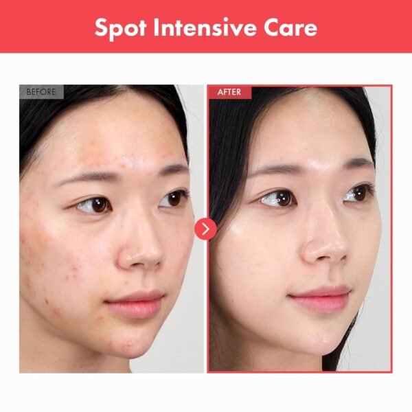 Ovalicin Skin Clear Cream, Skin Soothing, Moisturizing with Niacinamide and Sulfur, Korean Skincare, 50g, 1.76 oz. - Image 3