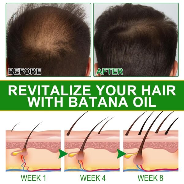 Batana Oil for Hair Growth and Nourishment - Scalp Massager Included, Honduras Pure & Natural Oil for Split Ends Elimination, Enhanced Hair and Skin Radiance, All Hair Types, 2.02 fl oz - Image 7