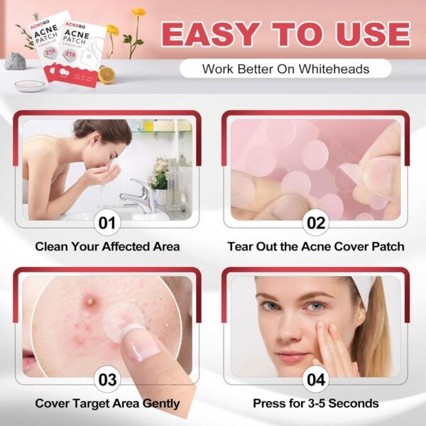 216 Counts Pimple Patches for Face, Hydrocolloid Acne Patches Zit Patches for Face Acne Spot Treatment Patch Cystic Acne Treatment Stickers Blemish Hydrocolloid Patches for all Skin Type - Image 7