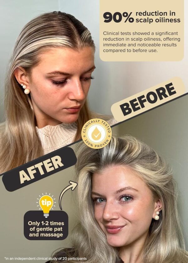 I DEW CARE Root Touch Up & Dry Shampoo Powder Set - Tap Secret Blonde + Original | Covering for Grey hair, Strengthening & Volumizing, Oil Control, Refillable, Travel size - Image 8