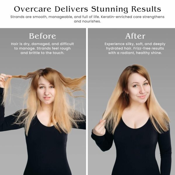OVERCARE Botox Hair Treatment Mask | 1000ml Deep Conditioning Hair Mask for Damaged, Dry Hair | Hair Botox Treatment with Keratin for Women - Provides Deep Hydration, Shine, and Smoothness - Image 4