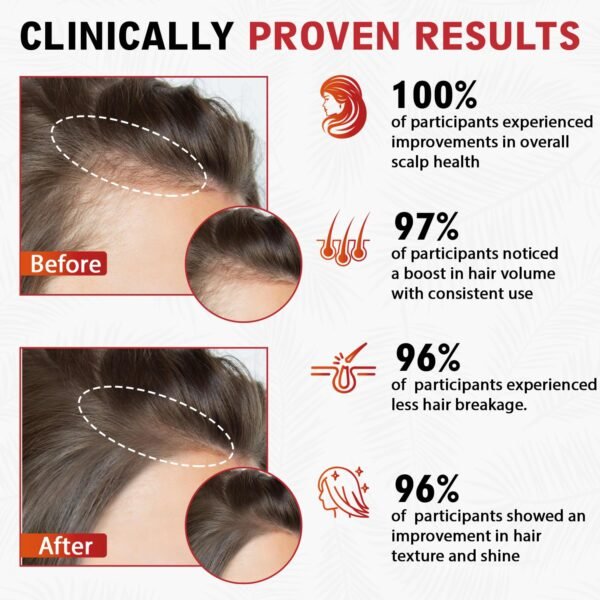 Batana Oil Shampoo for Hair Growth with Over 18+ Natural Ingredients, Rosemary Oil, Onion Biotin, Caffeine, DHT Blocker, Castor Oil, CLINICALLY TESTED, Anti Hair Thinning & Hair Loss, Sulfate Free - Image 5