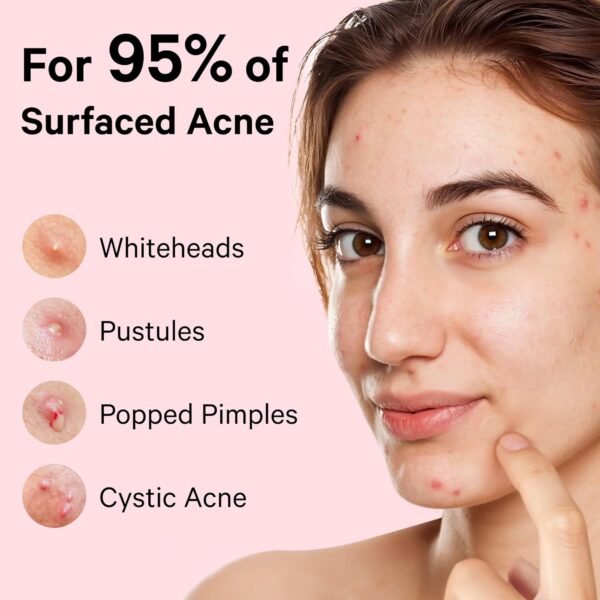 Sosky Pimple Patches for Face, FSA HSA Eligible Invisible Hydrocolloid Acne Patches, Zit Sticker for Face and Skin, Pimple Patches for Covering Zits, Blemishes with Salicylic Acid 48 Count - Image 8