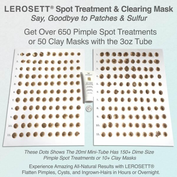 LEROSETT Facial Clay for Acne, Spot Treatment & Clay Mask, For Oily & Congested Skin, Reduces Blemishes, Blackheads & Pimples, Removes Ingrown Hairs, Tighten Pores, Vegan, 650+ Uses - Image 9