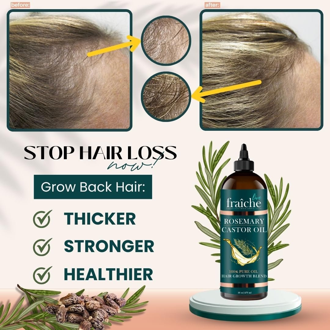 Live Fraiche Rosemary Castor Oil for Hair Growth 16oz - Rosemary Oil for Hair Growth and Thickening Pure Blend to Reduce Loss and Promote a Healthy Scalp - Image 3