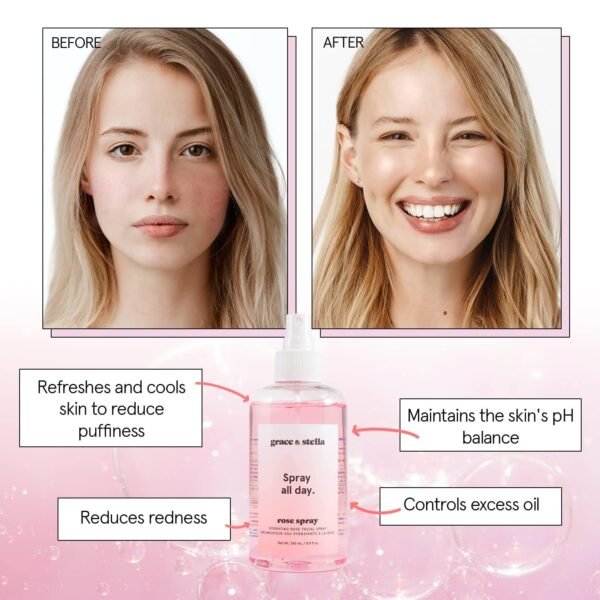 grace & stella Award Winning Rose Water Facial Spray (240ml) - Vegan - Rose Water Spray for Face - Rosewater Spray Toner Rose Hydrosol - Rose Spray Facial Mist - Rosewater Spray Toner Rose Hydrosol - Image 4