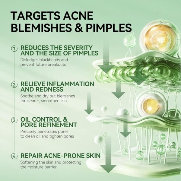LANBENA Precision Acne Spot Serum, Acne Drying Lotion, Overnight Acne Treatment For Face, Dry Out Pimples, Blemishes, Zits And Clean Pores, 0.42 Fl Oz - Image 4