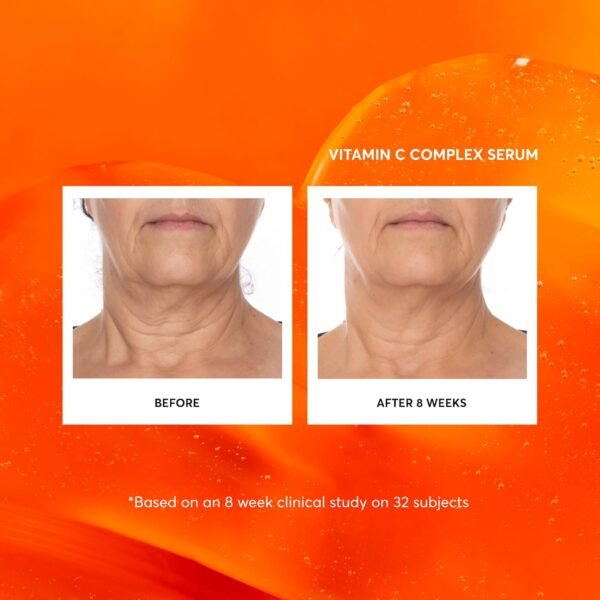 Naturium Vitamin C Complex Face Serum, Anti-Aging Facial Treatment with Hyaluronic Acid & Vitamin E, 1 oz - Image 4