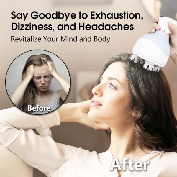 Zelikovitz Scalp Massager Hair Growth Electric Head Massager Scalp Massage Tool for Headaches, Head Scratcher Stress Relax, Cat Dog Head Massager - Image 5