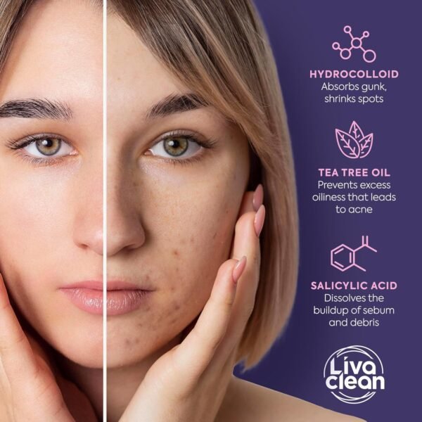 LivaClean Star Pimple Patches for Face w/Hydrocolloid, Salicylic Acid & Tea Tree, 240 Patches, Hydrocolloid Acne Patch, Cute Star Pimple Patch for Healing Stickers Zit Superstar - Image 7