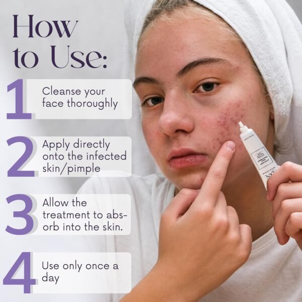 NXN Acne Edit Spot Treatment with Probiotics, Licorice Root, Ginger and Colloidal Sulfur, to rapidly reduce acne blemish size - Image 5