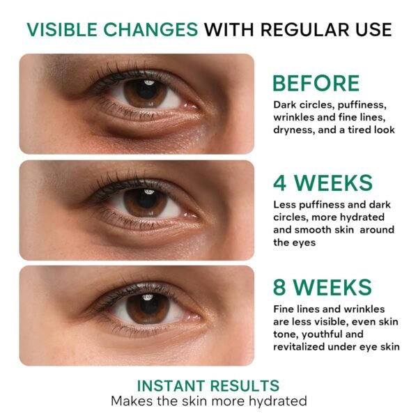 REMEDIAL PAX Eye Cream for Dark Circles and Puffiness, Bags Under Eyes Treatment, Anti-Aging Collagen Eye Cream for Wrinkles, Day & Night Caffeine Eye Cream with Niacinamide Dimethicone - Image 6