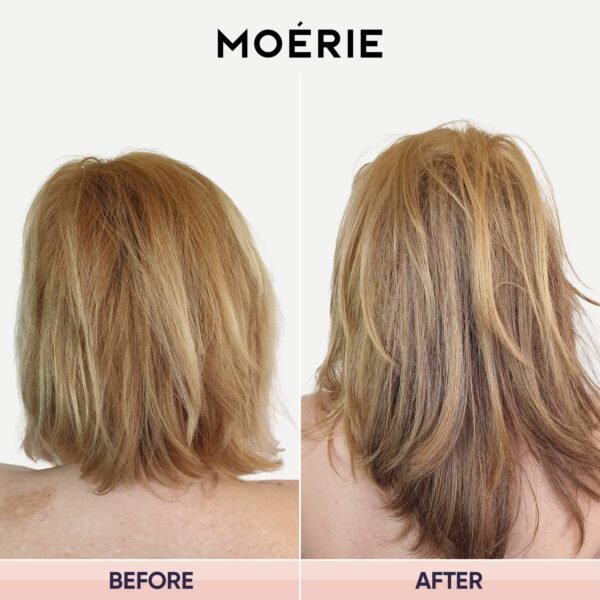 Moerie Hair Growth & Repair Mask - Restorative, Vegan-Friendly Treatment for Longer, Thicker, Fuller Hair - 100ml - Image 8
