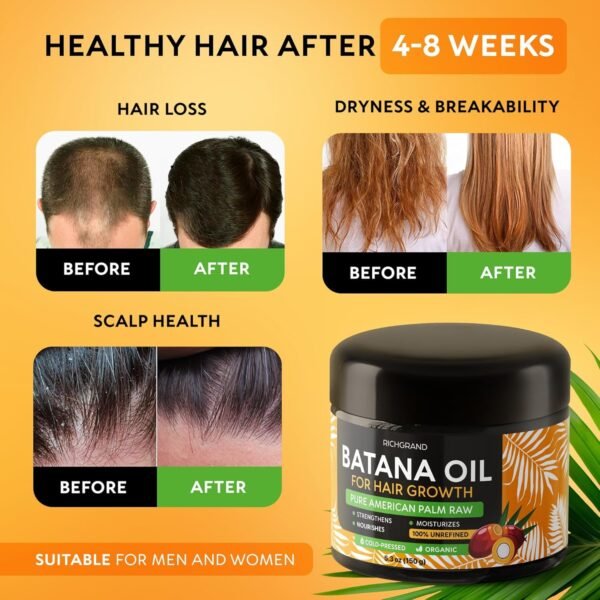 Batana Oil for Hair Growth - 100% Raw & Organic Dr Sebi Batana Oil - Cold-Pressed & Pure Unrefined Batana Hair Mask for Women & Men - Enhances Hair Thickness, Prevents Loss - Image 4