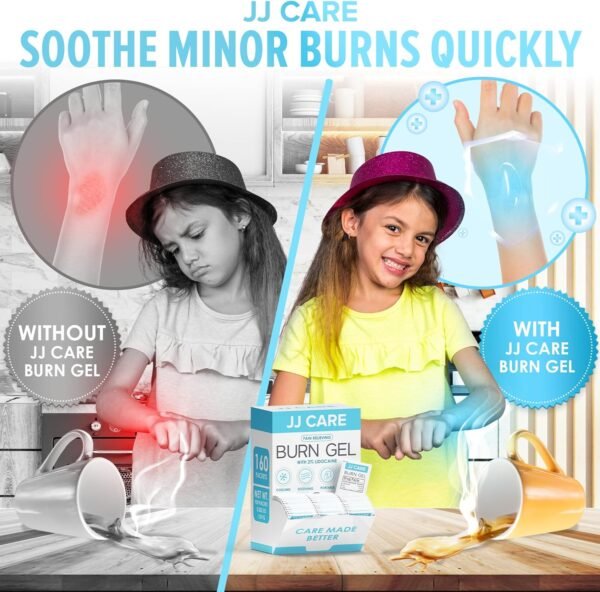 JJ CARE Burn Gel (Pack of 160), Soothing Burn Gel Packets for Minor Burns, First Aid Burn Gel Individual Packets with Lidocaine and Aloe Vera (0.9 Grams per Packet) - Image 5