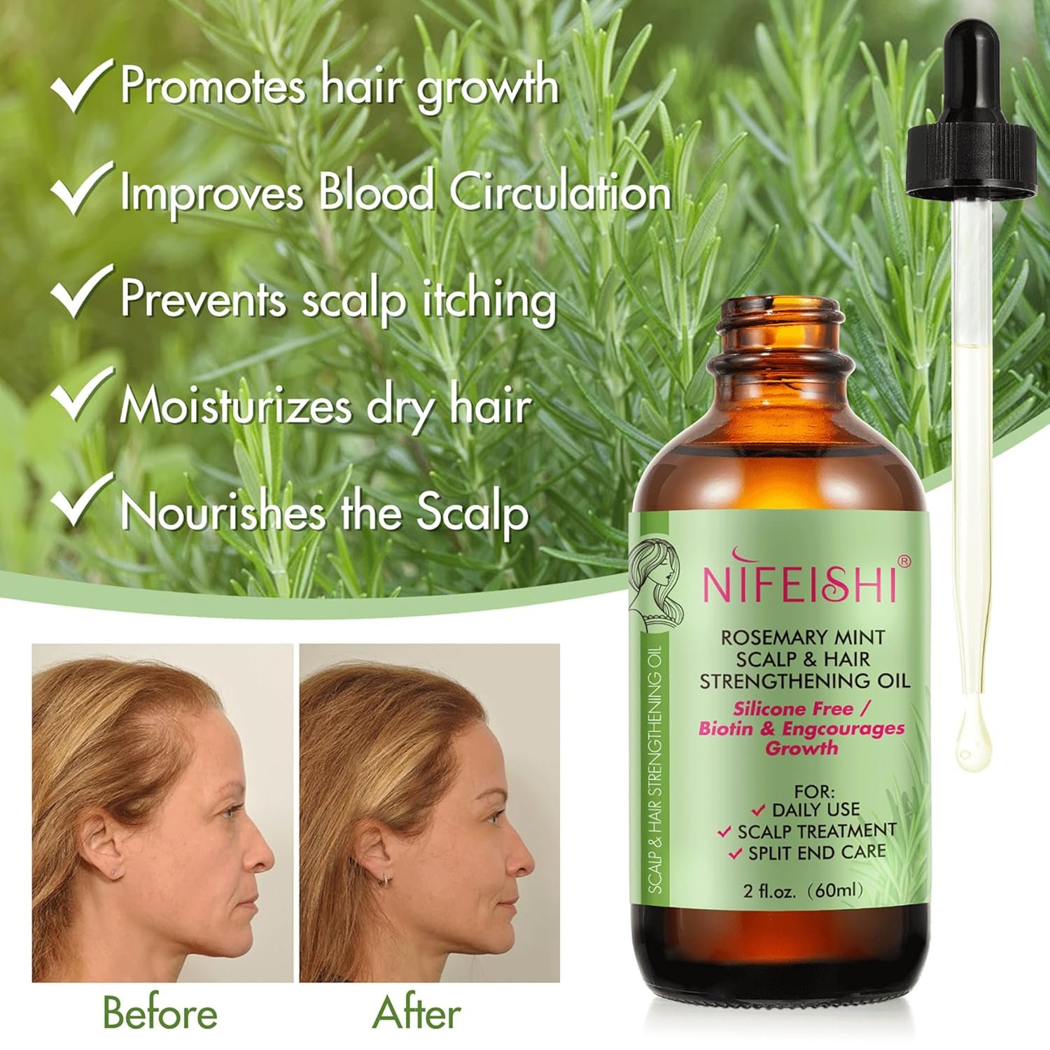 Rosemary Essential Oil for Hair Growth, Hair & Skin Care - Strengthens Hair, Stimulates Growth, 2.02 Fl Oz - Image 3