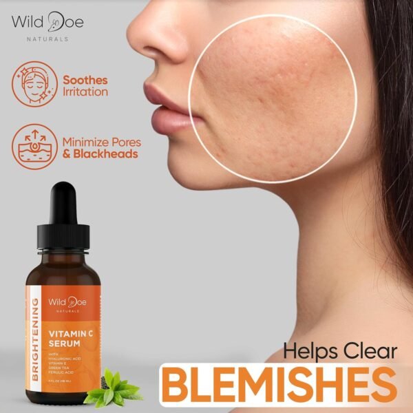 Vitamin C Serum for Face with Hyaluronic Acid - Firming Anti Aging Serum, Pore Minimizer, Acne Scars and Dark Spot Remover for Face - Vitamin C facial serum + Ferulic Acid, Vitamin E, Green Tea -4 oz - Image 8