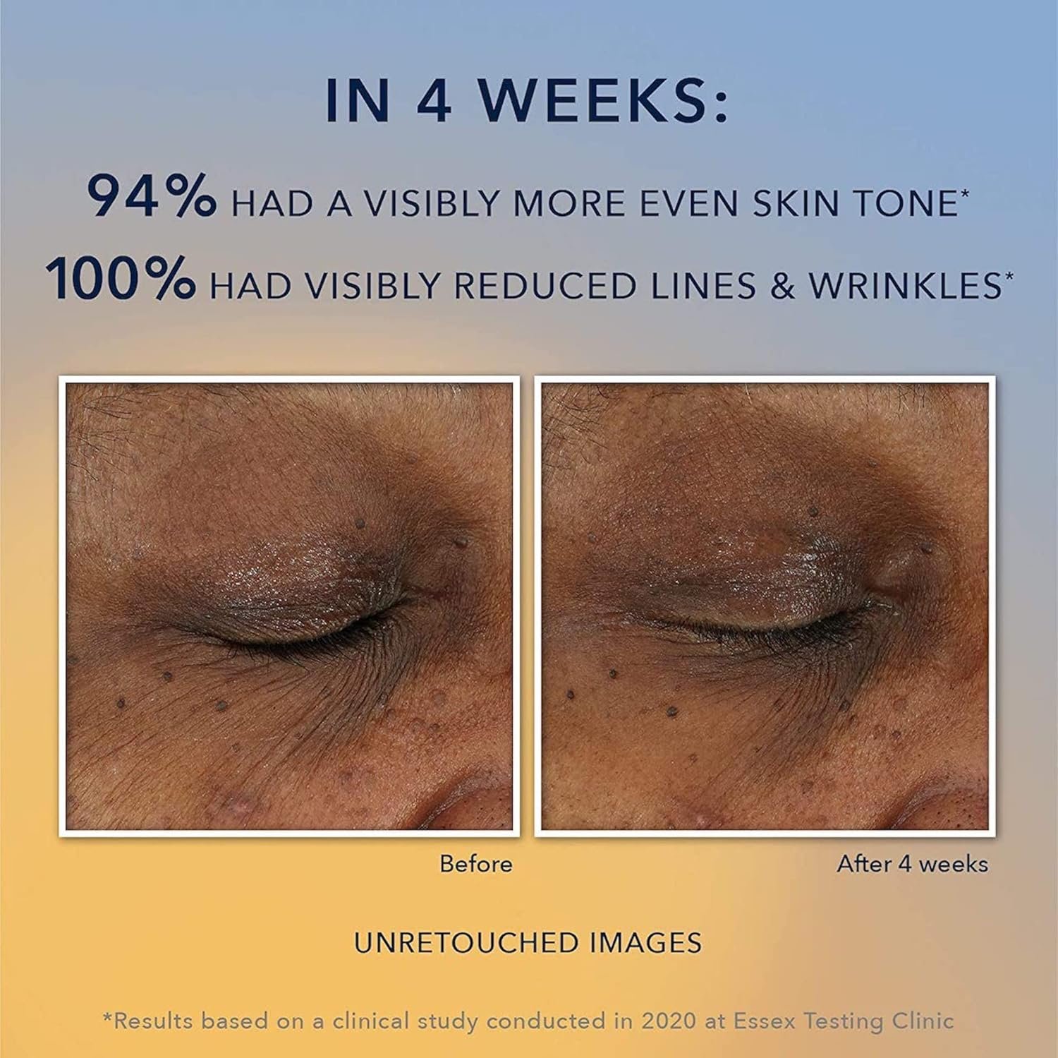 RoC Multi Correxion Revive + Glow 10% Active Vitamin C Serum for Face, Daily Anti-Aging Wrinkle and Skin Tone Skin Care Treatment, Brightening Serum, 1 Fluid Ounce - Image 4