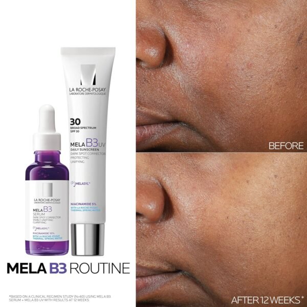 La Roche-Posay Mela B3 Serum, Dark Spot Corrector With Anti-Aging Melasy - Image 4