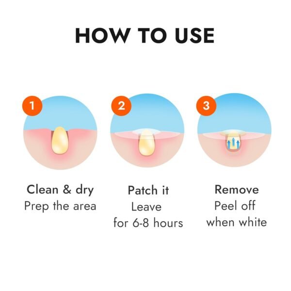 Epielle Over-Zit Acne Variety Patches | 84 Hydrocolloid Acne Pimple Patch for Covering Zits and Blemishes for Full Face (84 Counts) - Image 8