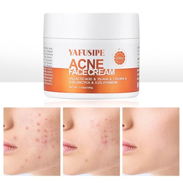 Acne Treatment for Face for Hormonal Cystic Stubborn Acne Cream for Sensitive Skin Teens Adults Women Men Spot Pimple Butt Control Rapid Clearing Breakout Overnight - Image 2