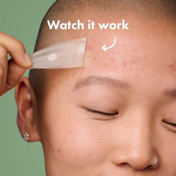 Mighty Patch Surface from Hero Cosmetics - Hydrocolloid Spot Patch for Body, Cheek, Forehead, and Chin, Vegan-friendly (10 Count) - Image 5