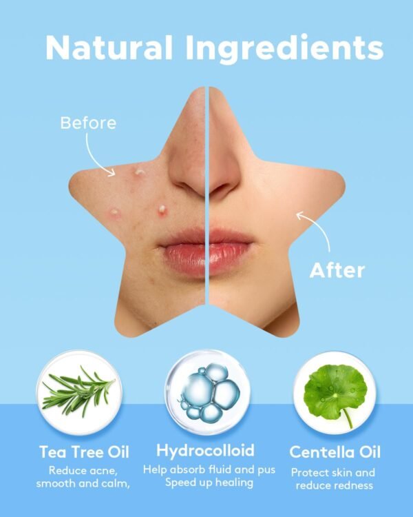 LitBear Acne Patch with Tea Tree & Centella Oil, 168 Hydrocolloid Dots in 6 Colors for Face - Cute Star Pimple Stickers - Image 4