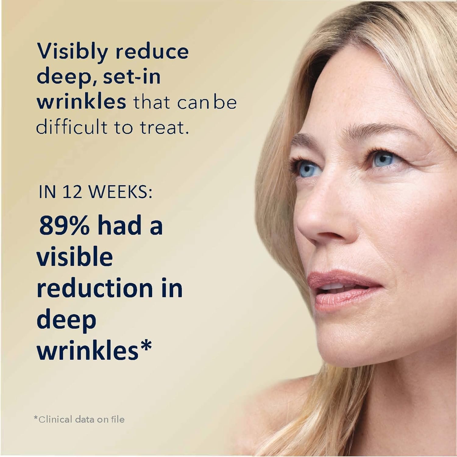 RoC Retinol Correxion Deep Wrinkle Retinol Face Serum with Ascorbic Acid, Daily Anti-Aging Skin Care Treatment for Fine Lines, Dark Spots, Acne Scars, 1 Ounce (Packaging May Vary) - Image 3