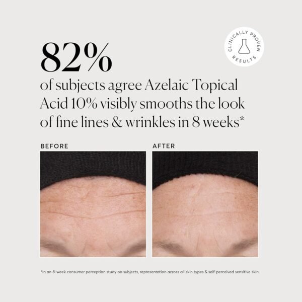 Naturium Azelaic Topical Acid 10%, Face & Skin Care Beauty Treatment with Niacinamide & Vitamin C, 1 oz - Image 5