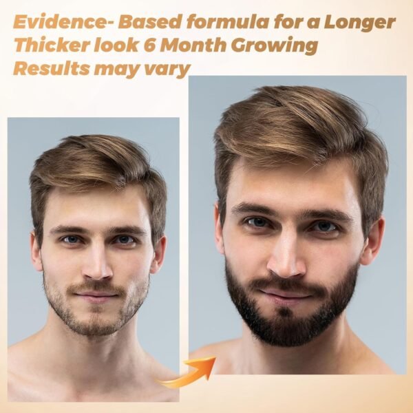 Beard Kit for Hair Growth for Men: Beard Growth Oil for Thicker Fuller Softer Facial Beard Natural Batana Oil Care Beard Growth Kit with Rosemary Oil Castor Oil Biotin - Image 5