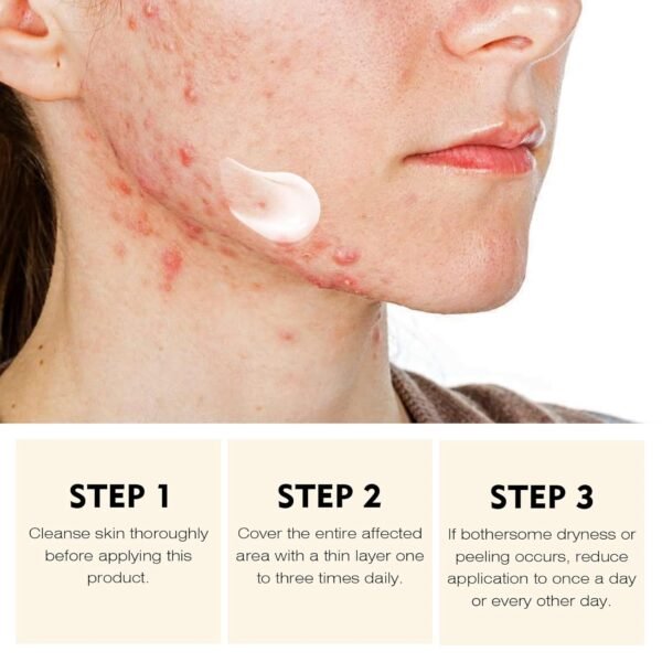 Acne Treatment for Face for Hormonal Cystic Stubborn Acne Cream for Sensitive Skin Teens Adults Women Men Spot Pimple Butt Control Rapid Clearing Breakout Overnight - Image 5