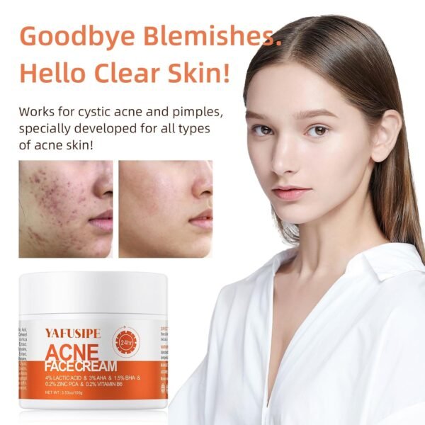 Acne Treatment for Face for Hormonal Cystic Stubborn Acne Cream for Sensitive Skin Teens Adults Women Men Spot Pimple Butt Control Rapid Clearing Breakout Overnight - Image 4