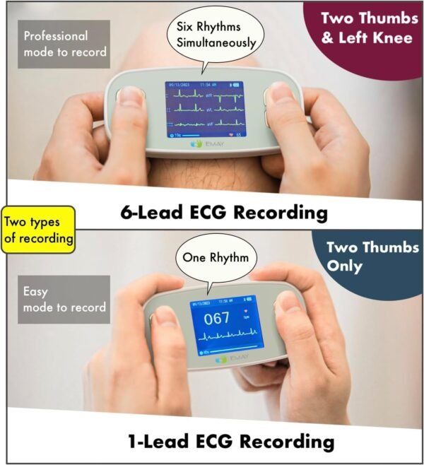 EMAY 6L Portable ECG Monitor | Record ECG and Heart Rate in 6 Channels | Compatible with Smartphone and PC | No Subscription Required - Image 6