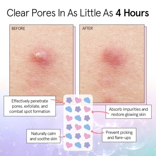 grace & stella Pimple Patches for Face - Cute Hydrocolloid Dots That Help Protect Acne & Reduce Redness - Fun Zit Stickers to Cover Blemishes - Dermatologist-Tested, Vegan (Multishape, 36 Count) - Image 4