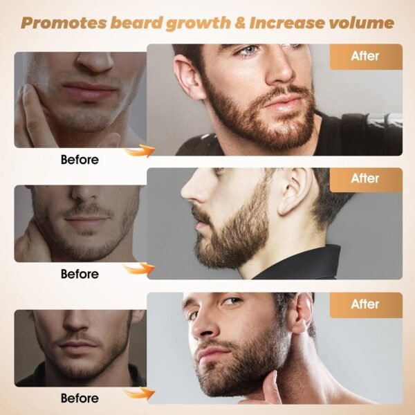 Beard Kit for Hair Growth for Men: Beard Growth Oil for Thicker Fuller Softer Facial Beard Natural Batana Oil Care Beard Growth Kit with Rosemary Oil Castor Oil Biotin - Image 4