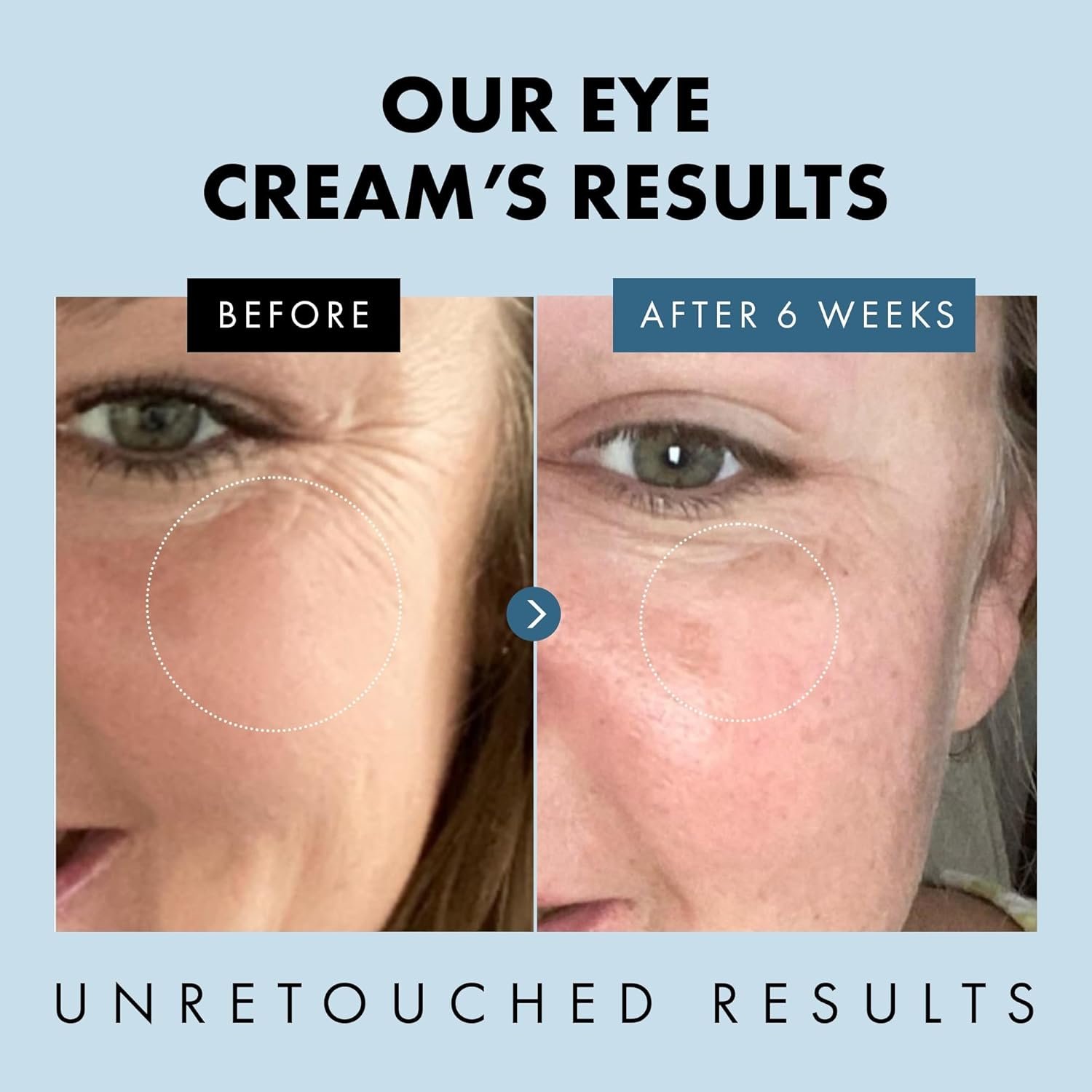 Under Eye Cream for Dark Circles and Puffiness - Eye Repair Cream Dark Circles Under Eye Treatment - Eye Cream Anti Aging Under Eye Serum Moisturizer Puffy Eyes Treatment Dark Circle - Image 5