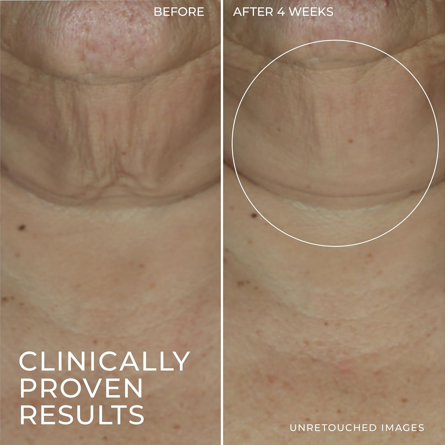 RoC Derm Correxion Advanced Retinol Firming Serum Stick with Antioxidants to Visibly Tighten and Firm Wrinkles and Laugh Lines, 1.0 oz with Retinol Eye Cream Packette - Image 7