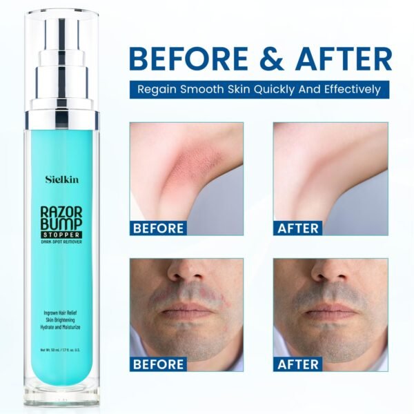 Shave Razor Bump Ingrown Hair Aftershave: Treatment Lotion for Sensitive Zone - Men & Women Skin Care Upgraded Formula 1.7 Fl Oz - Image 3