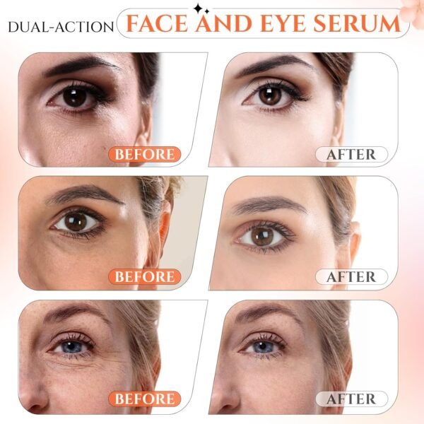Vitamin C Brightening Serum for Face, CE Ferulic Acid, Super Vitamin C Serum, Hyaluronic Acid Serum for face, Dark Spot Remover for Face Lifting, Firming Anti Aging Wrinkle Serum-1 Fl Oz. - Image 4