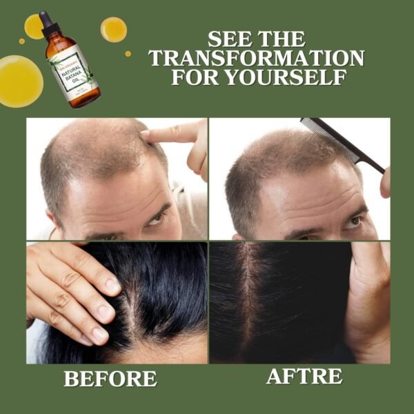 Batana Oil for Hair Growth Raw from Honduras, Dr Sebi Organic Raw Batana Oil, 100% Natural and Pure Hair Growth Oil Solution for Men & Women - Image 5
