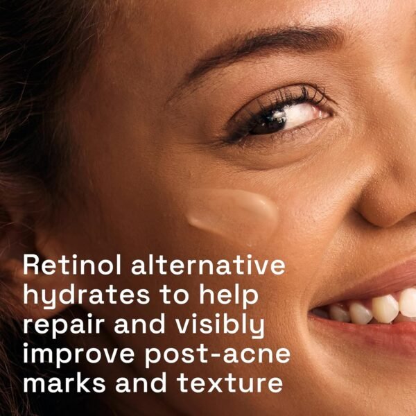 CETAPHIL Gentle Clear Repairing Post-Acne Serum, Retinol Alternative, Oil Free Serum for Sensitive Skin, 1 Fl Oz, Bakuchiol, Improves Skin Tone & Post-acne Marks, Dermatologist Recommended Brand - Image 4