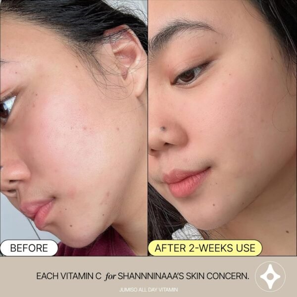 JUMISO All Day VC-IP 1.0 Firming Serum 30ml, 1.01 fl oz, Boosting Collagen, Reducing fine lines, Aronia Extract, Bakuchiol, Panthenol - Image 9