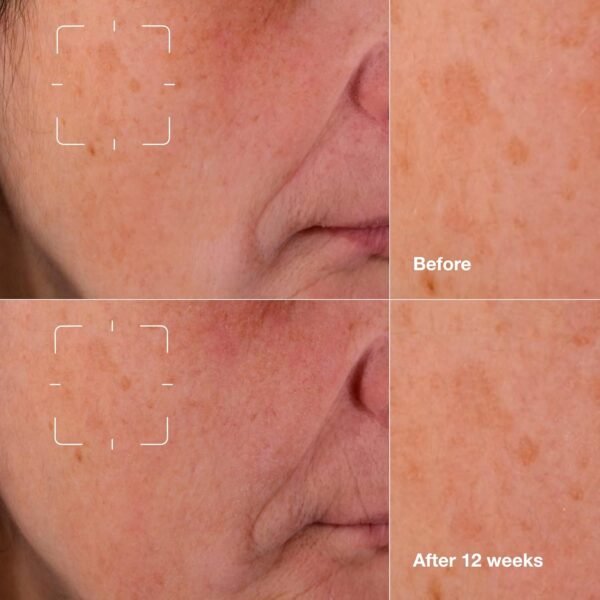 Clinique Even Better Clinical Dark Spot Clearing Serum With Vitamin C | Brightening + Soothing - Image 4