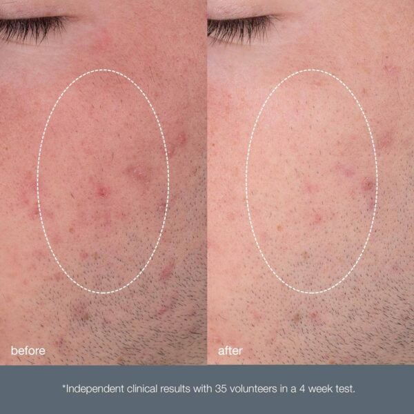 Dermalogica Daily Microfoliant, Face Exfoliator Scrub Powder with Salicylic Acid and Papaya Enzyme, Achieve Brighter, Smoother Skin Daily - Image 7