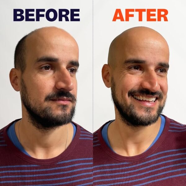 The FlexSeries Electric Head Hair Shaver - Freebird - Ultimate Mens Cordless Rechargeable Wet/Dry Skull & Bald Head Waterproof Razor with Rotary Blades, Clippers, Nose Trimmer, Brush, Massager - Image 9