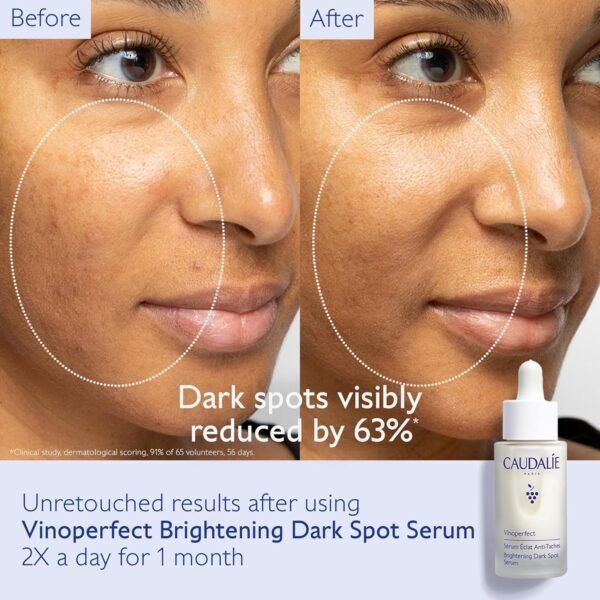 Caudalie Vinoperfect Brightening Dark Spot Serum Vitamin C Alternative - 62x More Effective than Vitamin C with Viniferine for a Visibly Brighter Even Complexion - Image 3